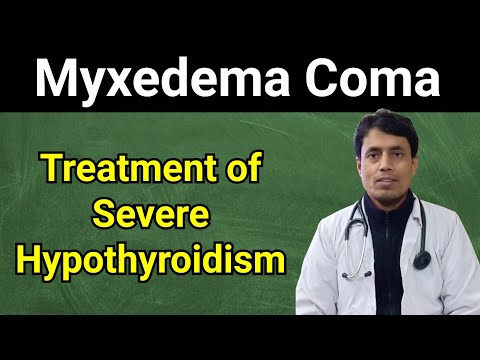 Myxedema Coma // Untreated Hypothyroidism // Serious Hypothyroidism // #DrSanjayChestSpecialist