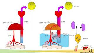 消化器疾患の外科　門脈体循環シャント編（肝外シャント中心）