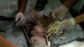 Baby Rescued From Inside Toilet Pipe In China