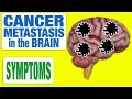 Cancer Metastasis in the Brain - All Symptoms