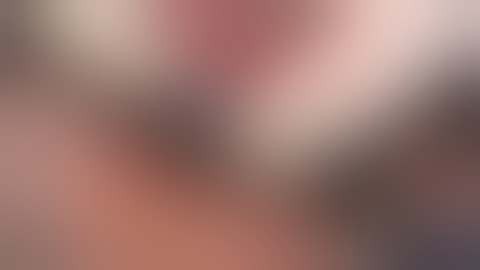 Dr  R  Crespi_Abutment extraction with Magnetic Mallet