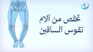 تقوس الساقين عند الكبار