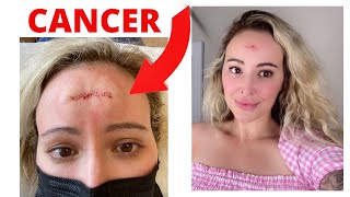 I HAVE CANCER- How did this happen?