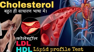 Cholesterol lipid profile test|LDL,HDL in Hindi|by DOCTORLab