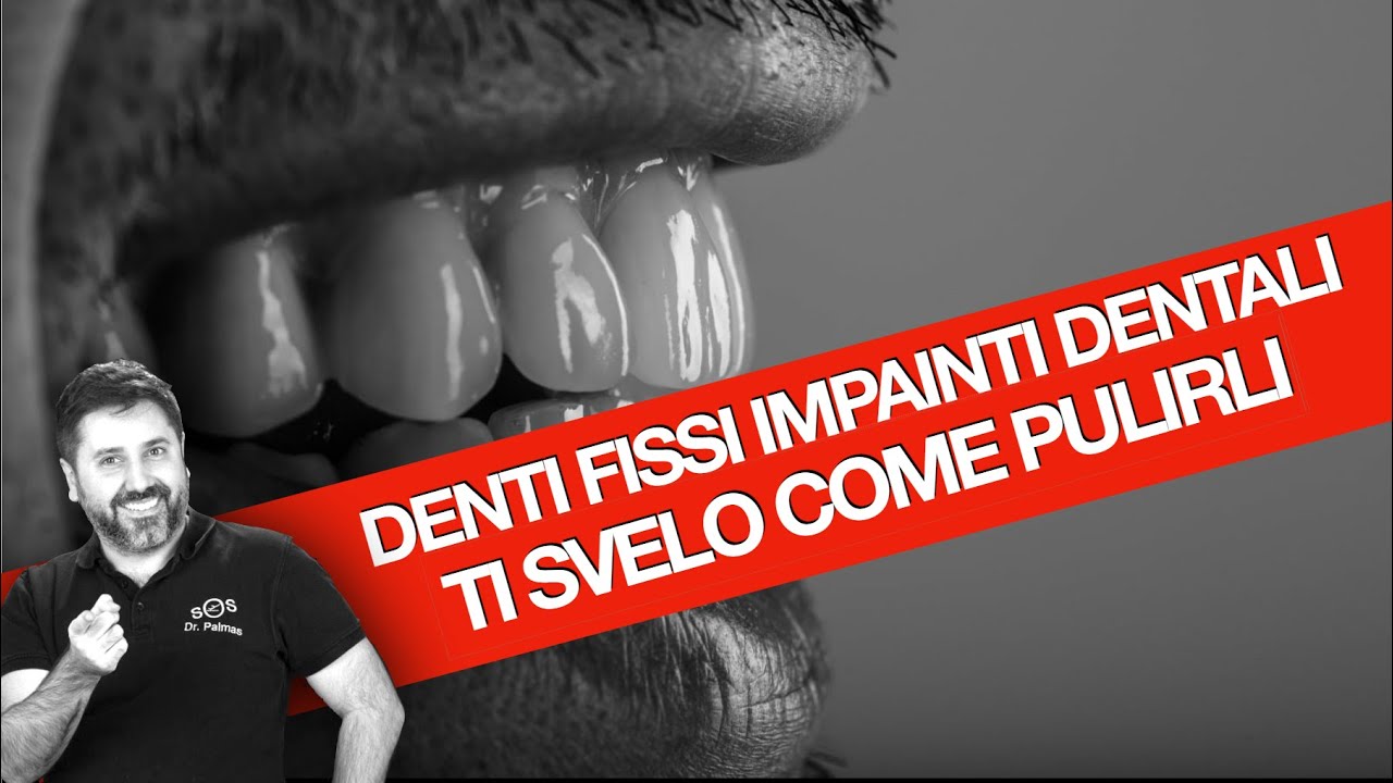 Dr Palmas: Dentista svela i segreti su come pulire i denti se hai gli impianti dentali.