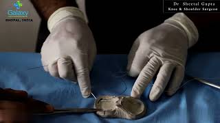 05 1 Micro Suture Lasso   Dry Bone Model Demo screenshot 5