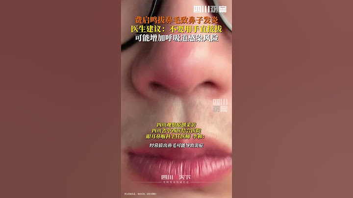 #医生赞同费齐鸣别没事儿拔鼻毛  4月2日，费启鸣发文称“朋友们，别没事儿拔鼻毛”，并配上鼻子红肿图片。医生提醒：暴力拔鼻毛可能引发炎症！ #医生建议用修剪器剪鼻毛