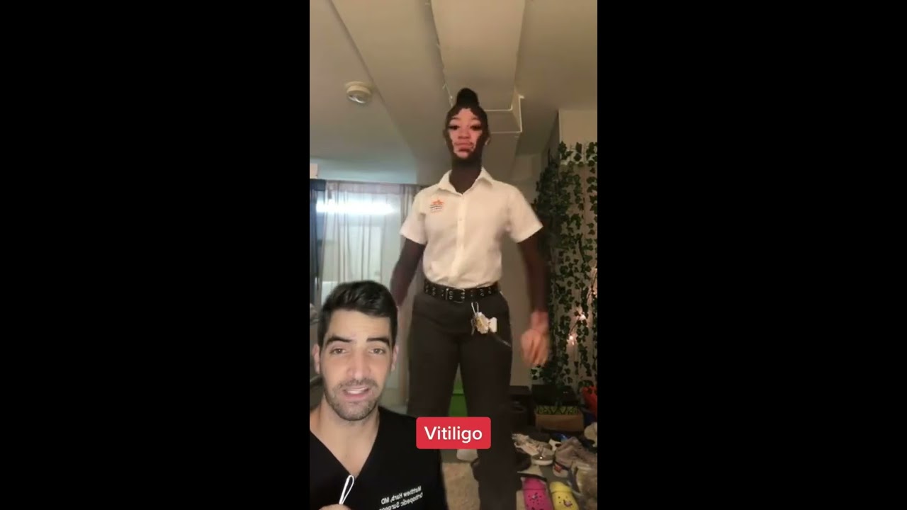 Autoimmune Diseases Vitiligo