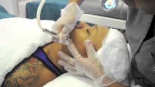 Crystal Free Microderm