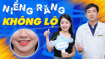 Niềng Răng Không Lộ | Lột Xác Cùng Nụ Cười Tươi Mới Của Cựu Du Học Sinh | Nam Bùi Vinalign