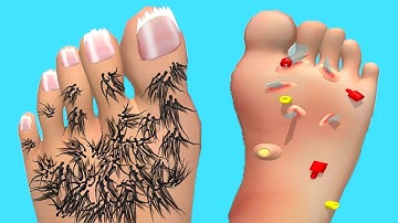 Foot Clinic - Gameplay Walkthrough - All Levels (IOS, Android)