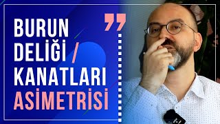 Burun kanatları asimetrisi ? ve Burun delikleri asimetrisi? aynı şey mi?