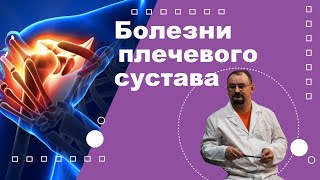 видео: Болезни плечевого сустава картинка: Болезни плечевого сустава