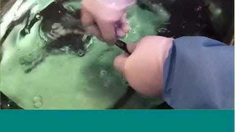 Cleaning the Duodenoscopes Elevator Mechanism