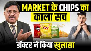 डॉक्टर ने बताया Market Chips का काला सच | Tasty Addiction or Dangerous Choice | Dr. Bimal Chhajer