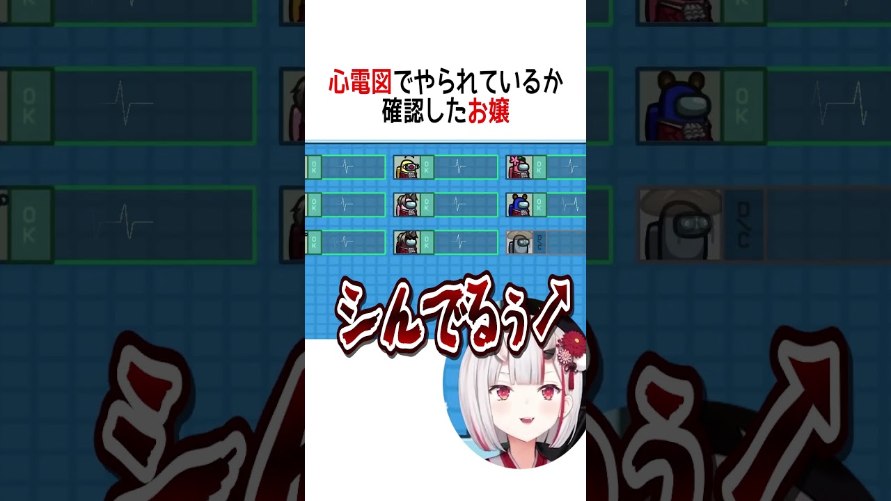 心電図でやられているか確認したお嬢【ホロライブ切り抜き】#shorts #百鬼あやめ