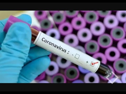 COVID-19-ის დადასტურებული 130 შემთხვევა, 26 გამოჯანმრთელებული