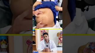 உங்களுக்கு சுகப்பிரசவம் வேண்டுமா? External cephallic version- Dr. Isacc Abbas