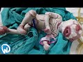 10 Unusual Babies That Really Exist!
