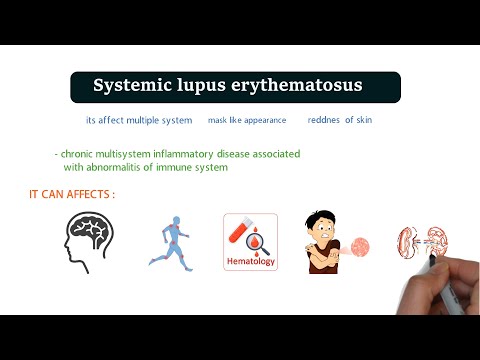 Systemic lupus erythematosus (SLE) - causes, symptoms, diagnosis , pathophysiology  & treatment