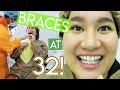 CLEAR BRACES at 32? MASAKIT Ba? | Kris Lumagui