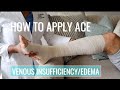 How to apply ace wrap for venous insufficiency ulcersedema  woundcarewednesday  fromcnatonp