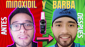 ¿Cómo saber si el minoxidil está haciendo efecto?