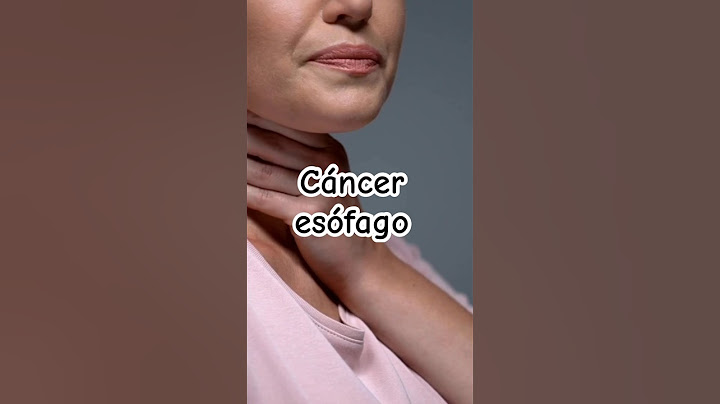 Síntomas de alerta de cáncer de esófago | Dr. William Guerrero. #medicina #shorts