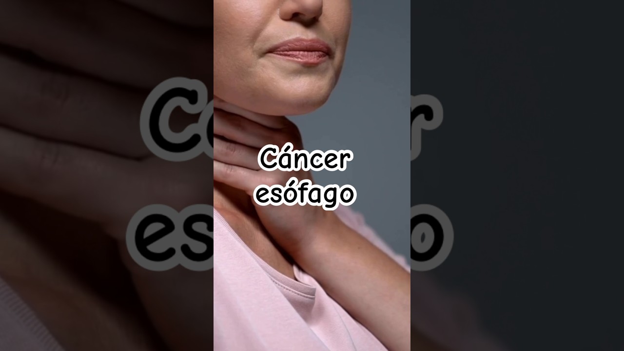 Síntomas de alerta de cáncer de esófago | Dr. William Guerrero. #medicina #shorts