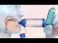 How to use a metered dose inhaler with a spacer