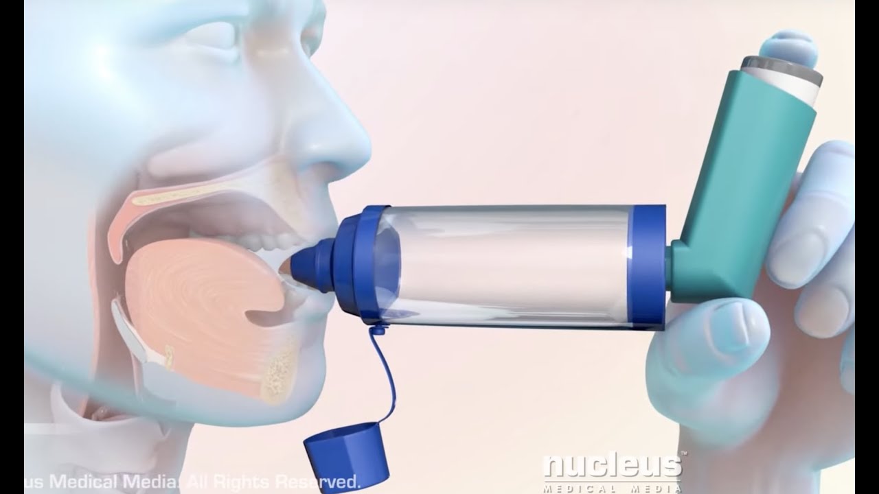 How to Use a Metered Dose Inhaler with a Spacer