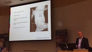 How to Achieve 95% Survival for CDH (Congential Diaphragmatic Hernia)