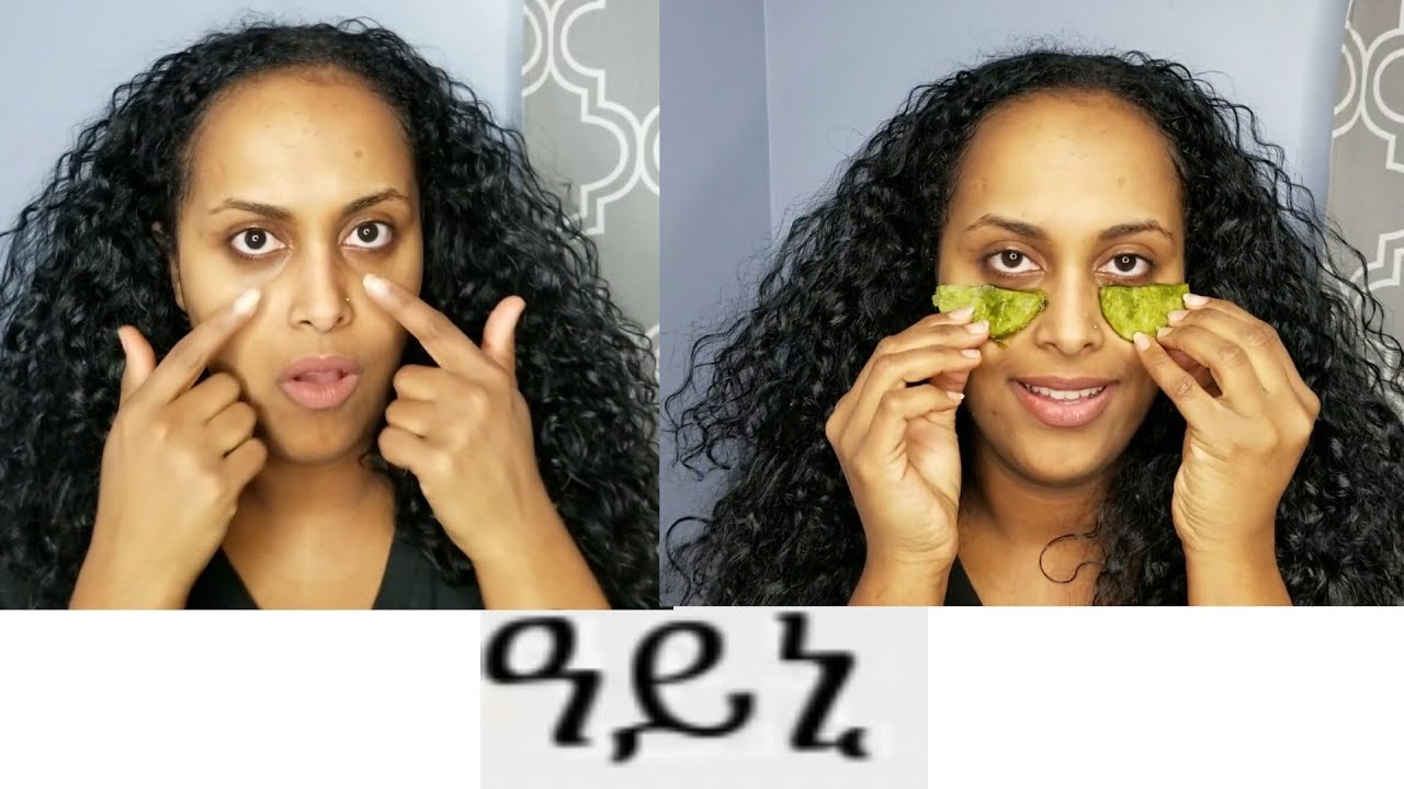 Eritrean Tigrigna Ney Ayni skincare Dark circle treatment