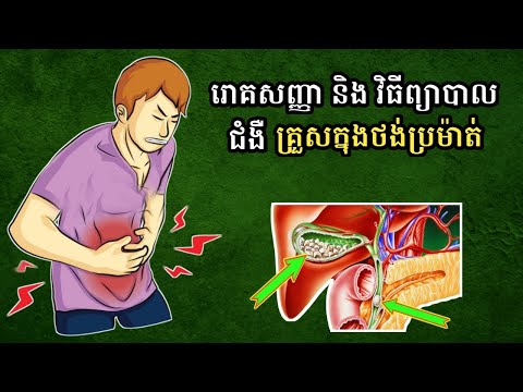 Symptoms and treatment of gallstones / ​រោគសញ្ញា និង វិធីព្យាបាលជំងឺគ្រួសក្នុងថង់ប្រម៉ាត់