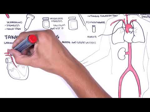 Giant cell Arteritis and Takayasu arteritis (Large Vessel Vasculitis) - signs, pathophysiology