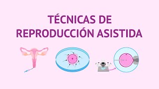 Técnicas de Reproducción Asistida