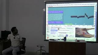 Lecture On Autonomic Nervous System Pharmacology: Epinephrine Biphasic Response &amp; BP Graphs | MBBS