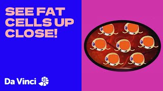What do Fat Cells look like? | Operation Ouch