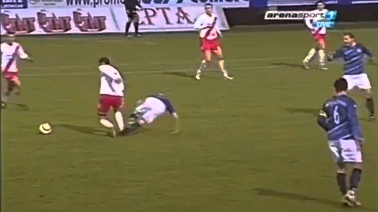 Worst leg-breaking on Soccer
