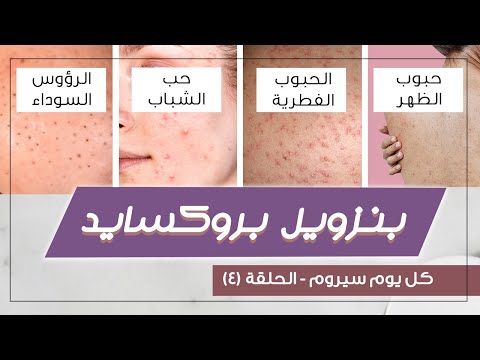 مقشر Benzoyl Peroxide لحب الشباب وحبوب الظهر والرؤوس السوداء