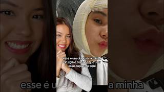 Contando Pra Vcs Sobre A Minha Cirurgia Plástica