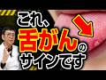 【医師解説】ただの口内炎と放置しないで！ 急増する「舌がん」の本当の原因と、命を救う5つの危険サイン