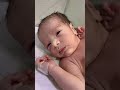 Baby Breathing Infection (LRTI) | NICU Care Guide#cute #baby #neonatologist #babycare #shorts