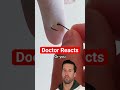 Er doctor reacts to fishing fail 