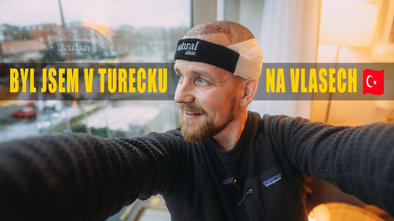 Byl jsem v Turecku na vlasech 🇹🇷