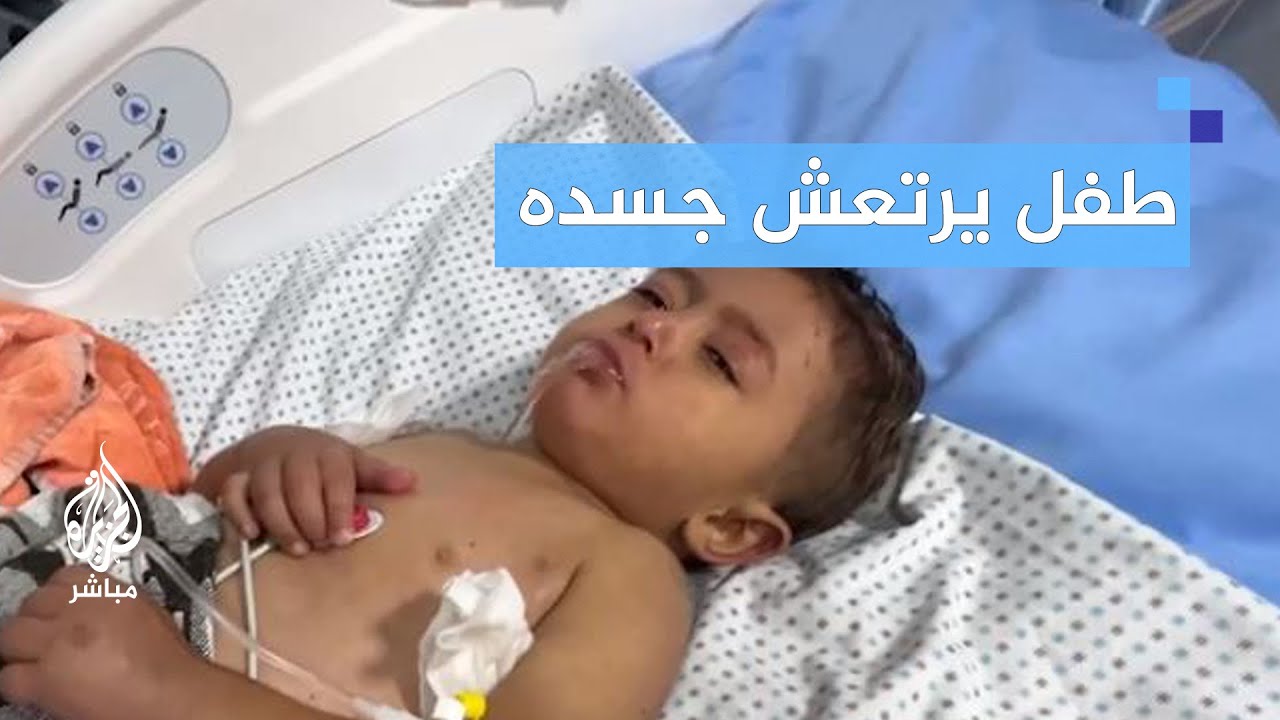 "التهابات حادة بالدم والقلب".. طفل فلسطيني على فراش العنايـة الحرجة