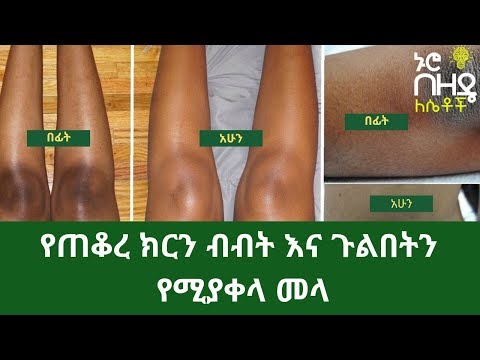 ቪዲዮ: የክርን አምባርን እንዴት እንደሚሸመን