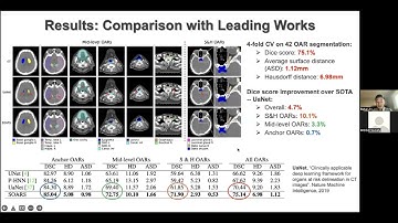 MICCAI Industrial Talk: Automated Target Volumes and Organs at Risk Segmentation