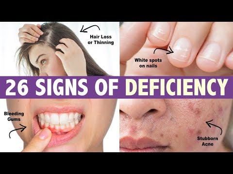 26 Signs Your Body is Deficient in VITAL Nutrients *life changing*