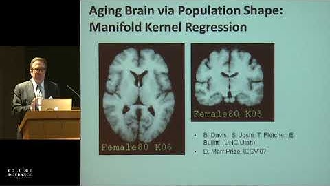 Spatiotemporal Analysis of Brain Development and Disease Progression